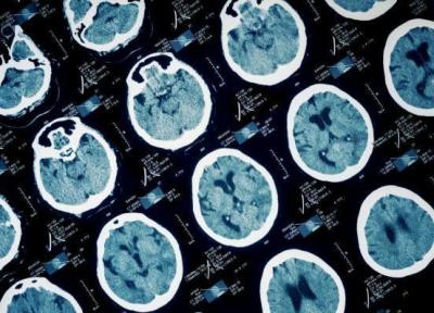 چگونه مغز ما زباله ها را بیرون می ریزد؟ چگونه مغز ما زباله ها را بیرون می ریزد؟