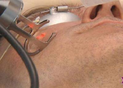 از بین بردن جای جوش با لیزر پوست از بین بردن جای جوش با لیزر پوست